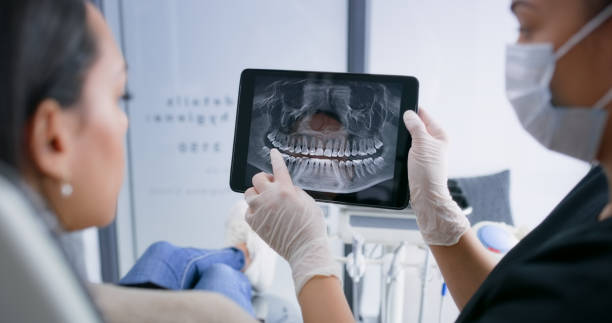 Licensed Wisdom Tooth Removal service in Garden City, GA - Smile Center Dentistry